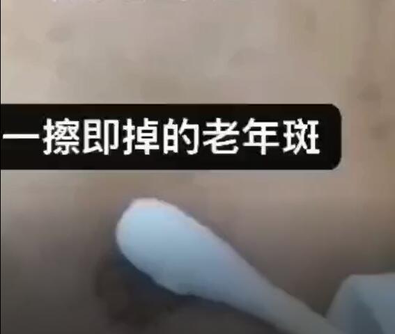 西美阁2秒祛斑，一擦即掉的老年斑过程视频演示